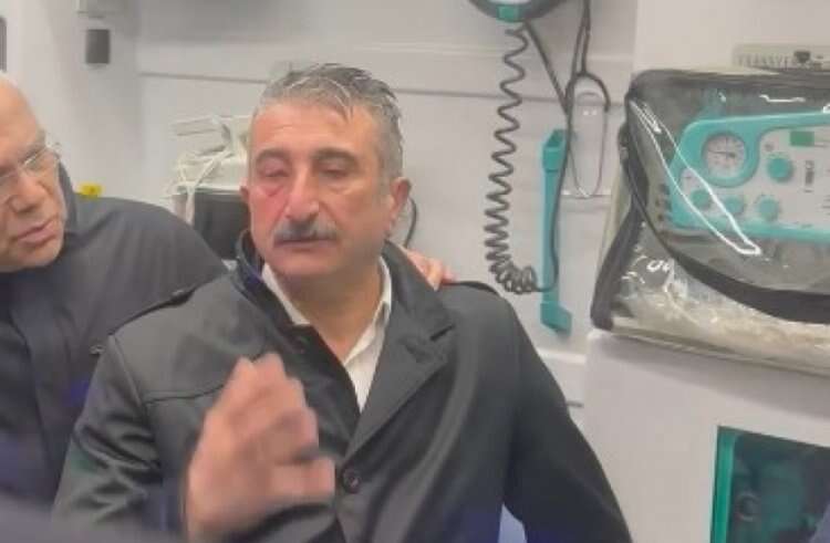 CHP Bursa İl Başkanı Yeşiltaş eylemlerde yaralandı!