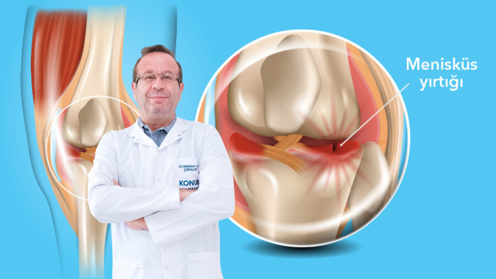Ortopedinin Bir Numaralı Gündemi: Diz Ağrıları! Op. Dr. Çuhadar’dan Kritik Uyarılar